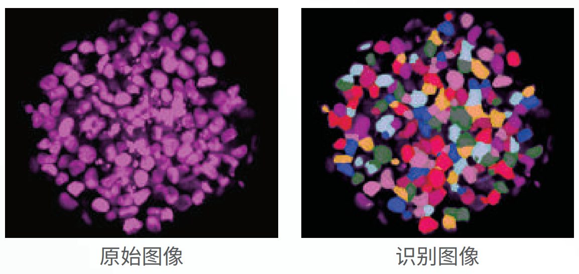應(yīng)用3：類器官、球體成像.png
