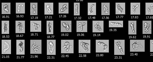 生物制藥研發(fā)-蛋白質聚集體.jpg